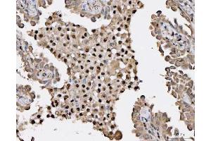 IHC analysis of HSF1 using anti-HSF1 antibody (ABIN7602894).
