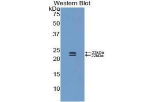 Western blot analysis of the recombinant protein. (BMP1 anticorps  (AA 856-982))