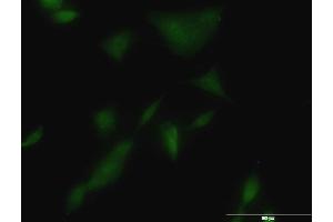 Immunofluorescence of monoclonal antibody to KLK3 on A-549 cell. (Prostate Specific Antigen anticorps  (AA 1-261))