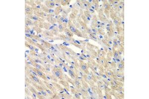 Immunohistochemistry of paraffin-embedded mouse heart using CARS antibody at dilution of 1:100 (x40 lens). (CARS anticorps)