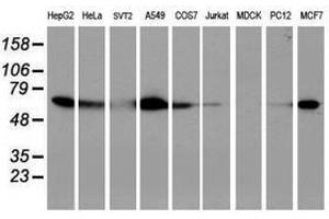 Image no. 9 for anti-Epsin 2 (EPN2) antibody (ABIN1498050)
