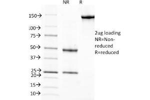 SDS-PAGE Analysis Purified RBP1 Mouse Monoclonal Antibody (G4E4).