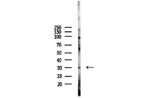 anti-Protein Phosphatase 1, Regulatory Subunit 3D (PPP1R3D) (Internal Region) antibody