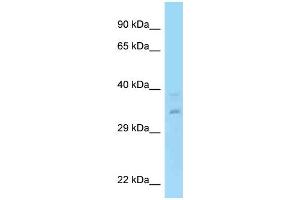 WB Suggested Anti-RPRD1A Antibody Titration: 1. (RPRD1A anticorps  (N-Term))