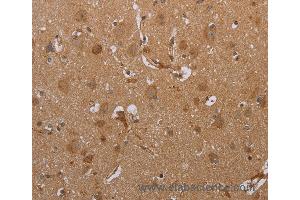 Immunohistochemistry of Human brain  using ATP2A1 Polyclonal Antibody at dilution of 1:35