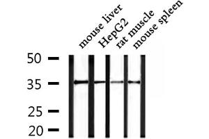 Western blot analysis of extracts from mouse liver and HepG2 and rat muscle and mouse spleen, using OR4F15 Antibody.