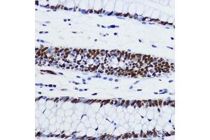 Immunohistochemistry of paraffin-embedded human colon using Acetyl-Histone H2B-K12 antibody (ABIN7267731) at dilution of 1:200 (40x lens). (Histone H2B anticorps  (acLys12))