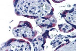 Human Placenta: Formalin-Fixed, Paraffin-Embedded (FFPE)