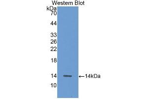 Western blot analysis of the recombinant protein. (ALT anticorps  (AA 147-263))