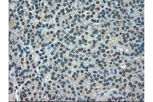 Image no. 6 for anti-NIMA (Never in Mitosis Gene A)-Related Kinase 6 (NEK6) antibody (ABIN1499686)