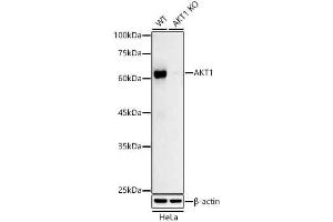Western blot analysis of extracts from wild type(WT) and  knockout (KO) HeLa cells, using  antibody (ABIN7271243) at 1:1000 dilution.