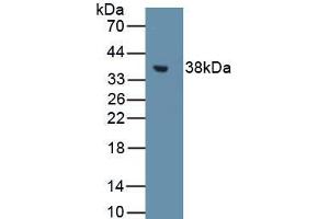 Western Blot Sample: Recombinant MT1, Rat (MT1 anticorps  (AA 1-61))