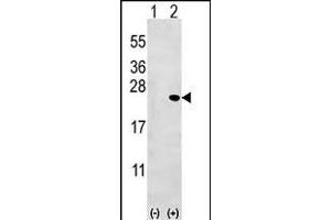 Western blot analysis of Bid (arrow) using rabbit polyclonal Bid Antibody (BH3) (ABIN388099 and ABIN2846183). (BID anticorps  (AA 68-103))