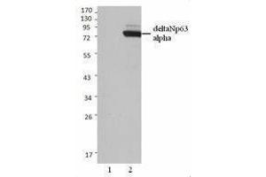 Western Blotting (WB) image for anti-T-Complex 1 (TCP1) antibody (ABIN2666193) (TCP1 alpha/CCTA anticorps)