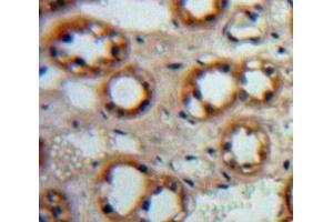 Used in DAB staining on fromalin fixed paraffin-embedded Kidney tissue (EGF anticorps  (AA 977-1029))