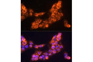 Immunofluorescence analysis of  cells using L Polyclonal Antibody (ABIN6128174, ABIN6143076, ABIN6143077 and ABIN6219002) at dilution of 1:100 (40x lens). (LAMC2 anticorps  (AA 862-1111))