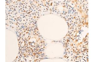 ABIN6256630 and ABIN6267283 at 1/100 staining rat appendiceal tissue sections by IHC-P. (ErbB2/Her2 anticorps  (pTyr1248))