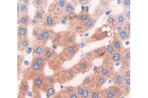 Used in DAB staining on fromalin fixed paraffin- embedded Kidney tissue