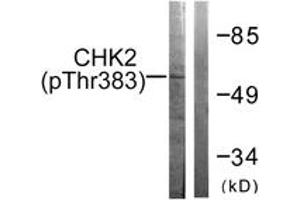 Western blot analysis of extracts from COS7 cells treated with UV 30', using Chk2 (Phospho-Thr383) Antibody. (CHEK2 anticorps  (pThr383))