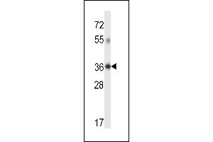 DHRS7C Antibody (Center) (ABIN657710 and ABIN2846701) western blot analysis in human placenta tissue lysates (35 μg/lane). (DHRS7C anticorps  (AA 116-145))