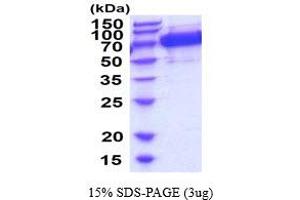 SDS-PAGE (SDS) image for Galactosidase, beta 1 (GLB1) (AA 24-677) protein (His tag) (ABIN6387747)