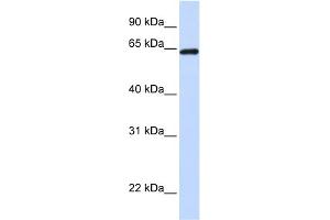 WB Suggested Anti-LCP1 Antibody Titration: 0. (LCP1 anticorps  (C-Term))