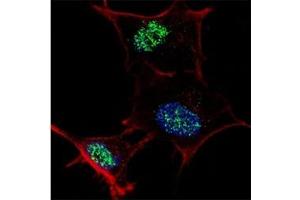 Fluorescent confocal image of SY5Y cells stained with KLF4 antibody at 1:100.