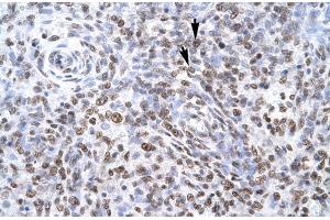 Human Spleen; ZNF500 antibody - middle region in Human Spleen cells using Immunohistochemistry (ZNF500 anticorps  (Middle Region))