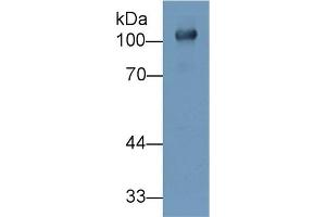 Detection of UMOD in Human Urine using Polyclonal Antibody to Uromodulin (UMOD)