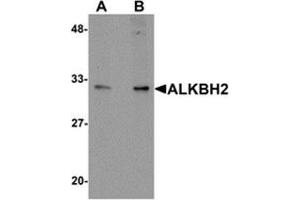 Western blot analysis of ALKBH2 in human kidney tissue lysate with ALKBH2 antibody at (A) 1 and (B) 2 μg/ml. (ALKBH2 anticorps  (C-Term))