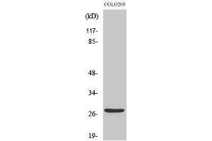 Western Blotting (WB) image for anti-Tumor Protein P53 Inducible Nuclear Protein 1 (TP53INP1) (C-Term) antibody (ABIN3187308) (TP53INP1 anticorps  (C-Term))