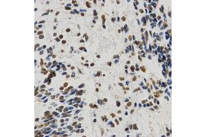 Immunohistochemistry (IHC) image for anti-Histone H3 (H3) (H3K9me) antibody (ABIN3023257)