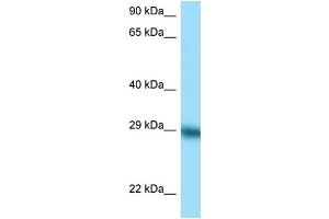 WB Suggested Anti-TFPI Antibody Titration: 1. (TFPI anticorps  (C-Term))