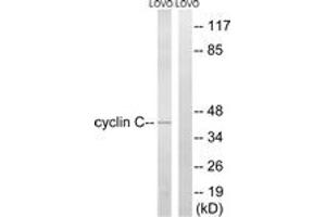 Western blot analysis of extracts from LOVO cells, using Cyclin C (Ab-275) Antibody. (Cyclin C anticorps  (AA 234-283))