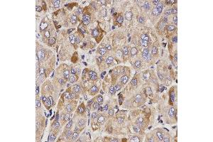 Immunohistochemistry (IHC) image for anti-Growth Arrest-Specific 2 (GAS2) (AA 1-100) antibody (ABIN3021611)