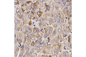 Immunohistochemistry (IHC) image for anti-Growth Arrest-Specific 2 (GAS2) (AA 1-100) antibody (ABIN6215372) (GAS2 anticorps  (AA 1-100))
