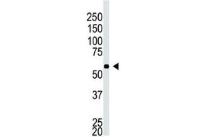 Western blot testing of BACE2C antibody and A549 cell lysate (BACE2C anticorps  (AA 310-339))