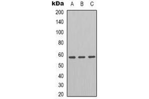 Western blot analysis of GRP58 expression in HT29 (A), K562 (B), A549 (C) whole cell lysates. (PDIA3 anticorps)