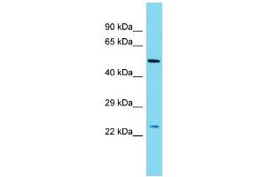 Host: Rabbit Target Name: MBD3L2 Sample Type: Placenta lysates Antibody Dilution: 1. (MBD3L2 anticorps  (Middle Region))