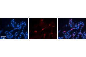 Rabbit Anti-CIAO1 Antibody     Formalin Fixed Paraffin Embedded Tissue: Human Lung Tissue  Observed Staining: Cytoplasmic in alveolar type I cells  Primary Antibody Concentration: 1:100  Other Working Concentrations: 1/600  Secondary Antibody: Donkey anti-Rabbit-Cy3  Secondary Antibody Concentration: 1:200  Magnification: 20X  Exposure Time: 0. (CIAO1 anticorps  (Middle Region))