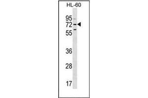 Western blot analysis of MBTD1 Antibody (C-term) in HL-60 cell line lysates (35ug/lane). (MBTD1 anticorps  (C-Term))