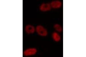 ABIN6275720 staining Hela by IF/ICC. (IKZF2 anticorps  (Internal Region))