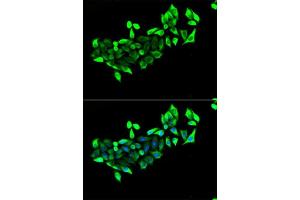 Immunofluorescence analysis of U2OS cells using FLOT1 antibody.