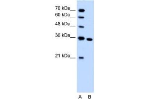 WB Suggested Anti-SLC25A29 Antibody Titration:  1. (SLC25A29 anticorps  (C-Term))