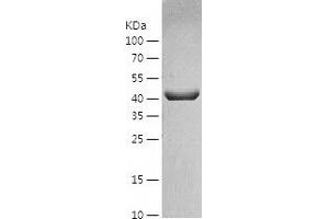Western Blotting (WB) image for Clusterin (CLU) (AA 23-449) protein (His-IF2DI Tag) (ABIN7122412)
