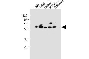 All lanes : Anti-PDCD4 Antibody (Center) at 1:2000 dilution Lane 1: Hela whole cell lysate Lane 2: Jurkat whole cell lysate Lane 3: HepG2 whole cell lysate Lane 4: Mouse thymus tissue lysate Lane 5: Rat thymus tissue lysate Lysates/proteins at 20 μg per lane.