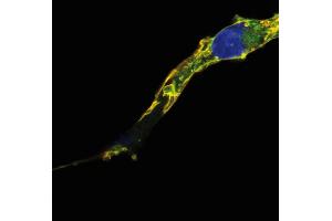 Immunocytochemistry analysis of colocalization of R-Ras2/TC21 signal (red) and GFP signal (green) in COS cells transfected with R-Ras2/TC21-GFP construct, after fixation and permeabilization. (R-RAS2 anticorps)