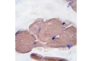 Image no. 2 for anti-Myostatin (MSTN) (N-Term) antibody (ABIN357462)