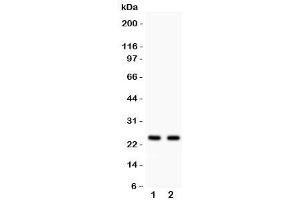 Western blot testing of Rab3A antibody and Lane 1:  rat brain