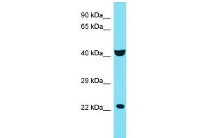 Host: Rabbit Target Name: C4orf51 Sample Type: 721_B Whole Cell lysates Antibody Dilution: 1. (C4ORF51 anticorps  (C-Term))